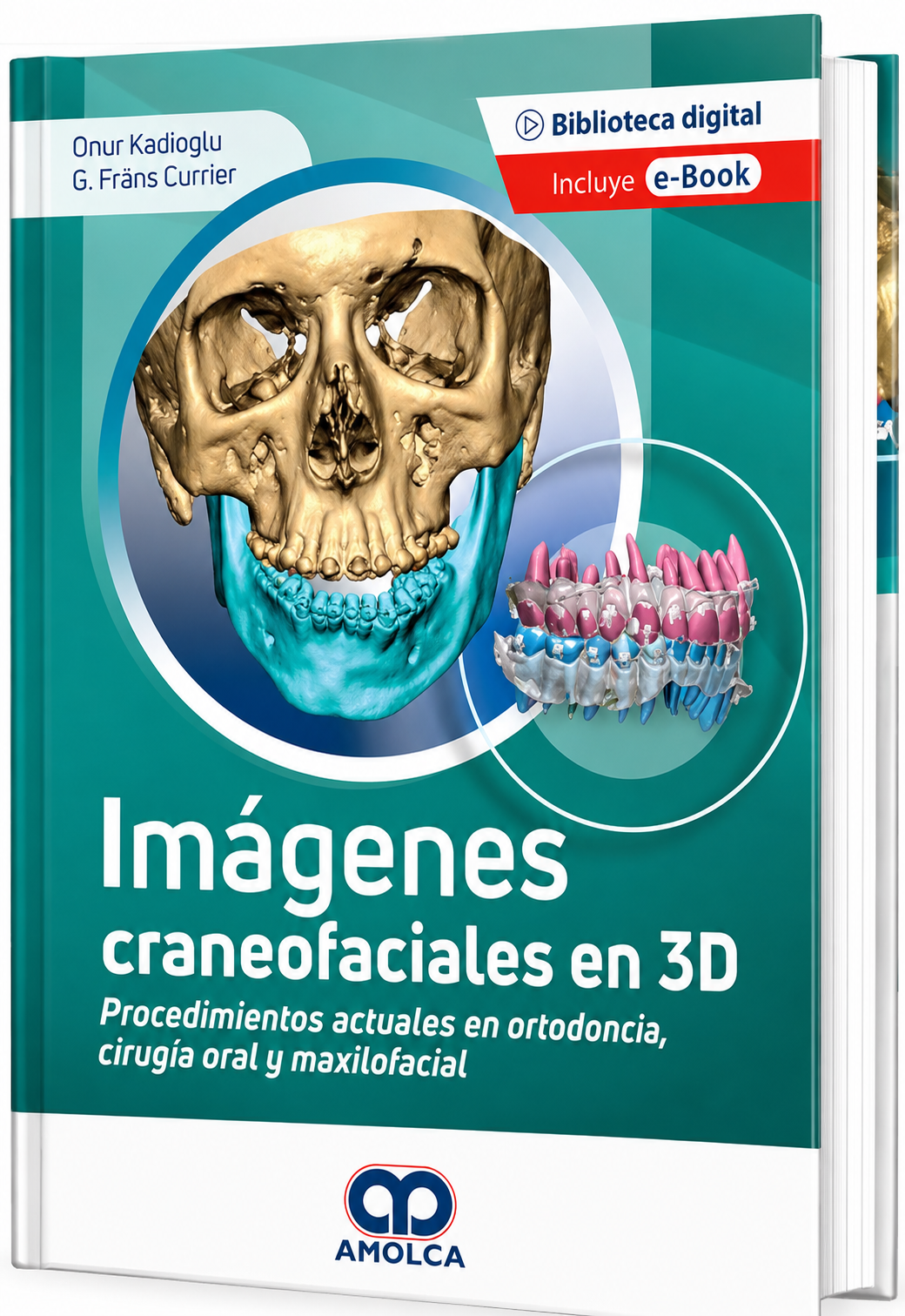 Imágenes Craneofaciales en 3D