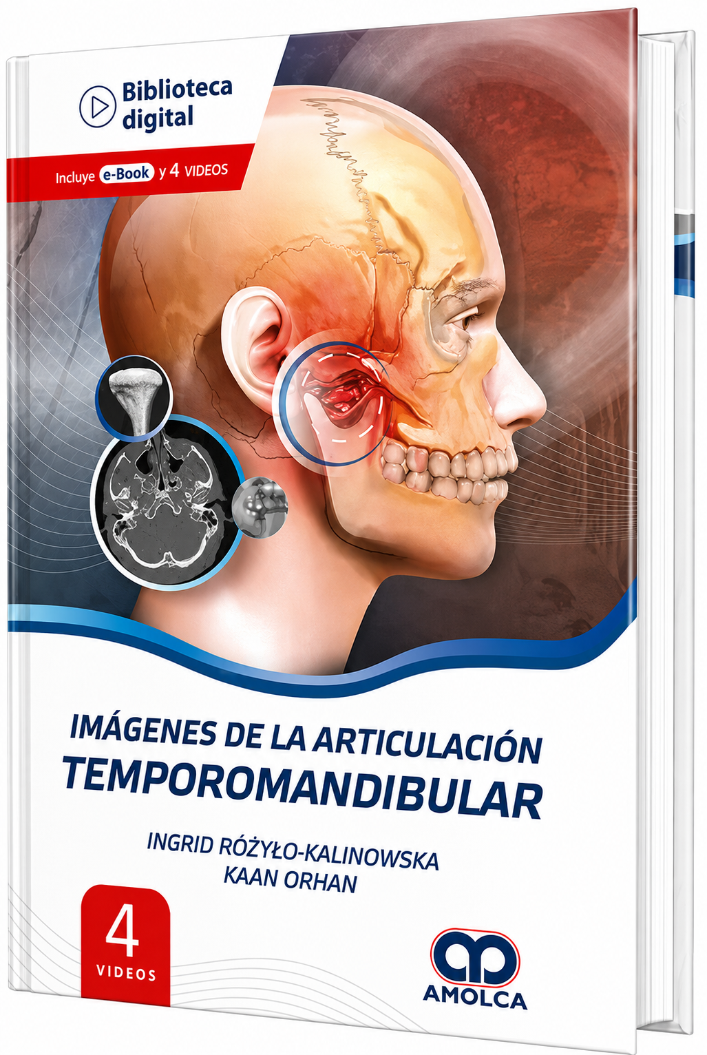 Imágenes de la Articulación Temporomandibular