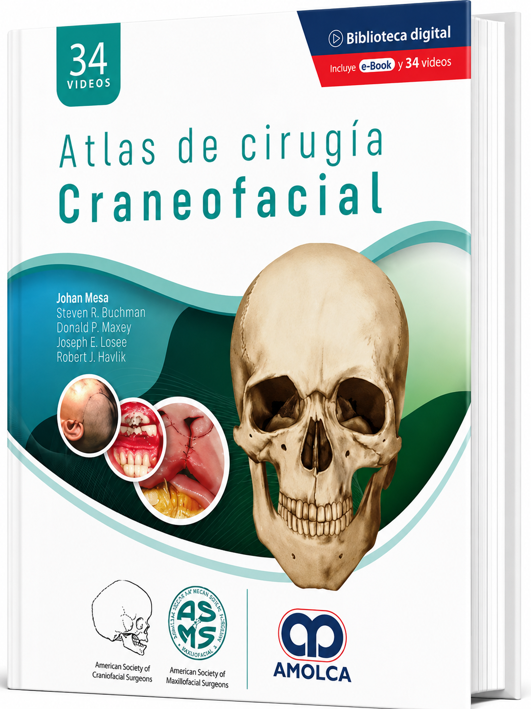 Atlas de Cirugía Craneofacial