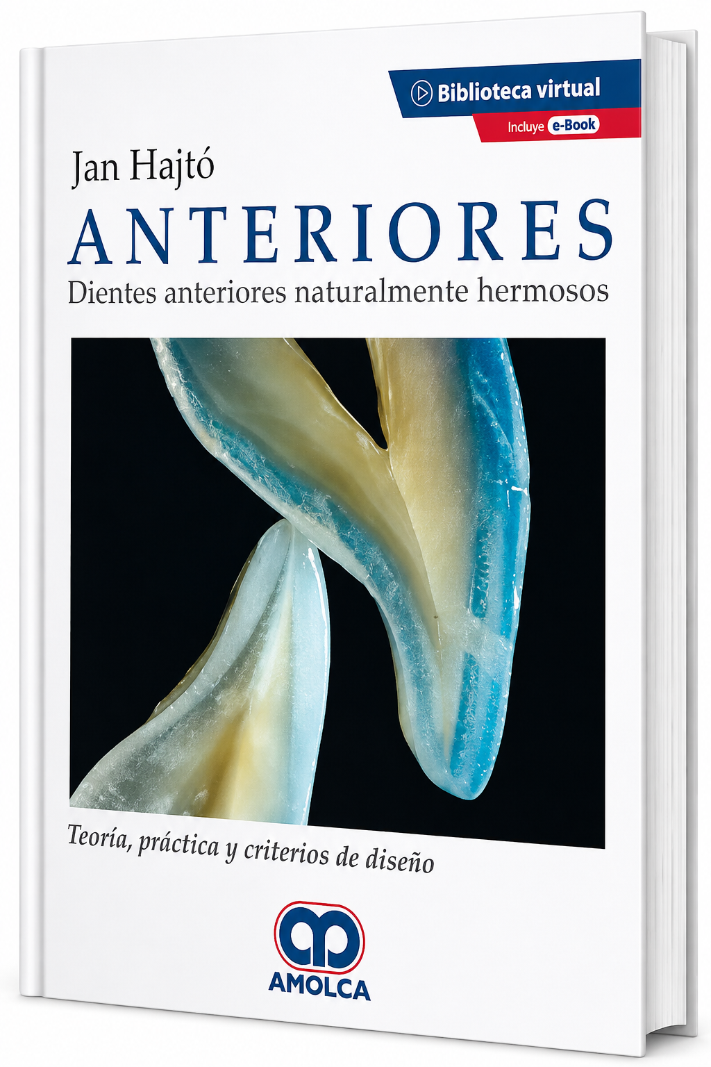 Anteriores. Dientes Anteriores Naturalmente Hermosos. Teoría, Práctica y Criterios de Diseño