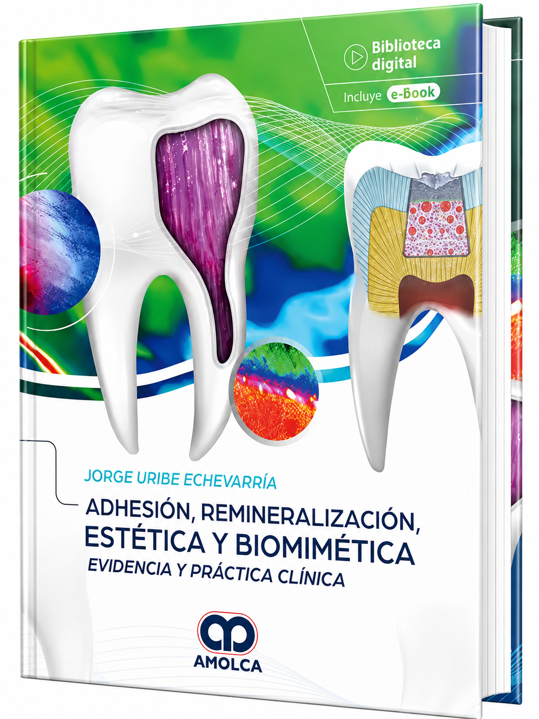 Adhesión, Remineralización, Estética y Biomimética. Evidencia y Práctica Clínica.