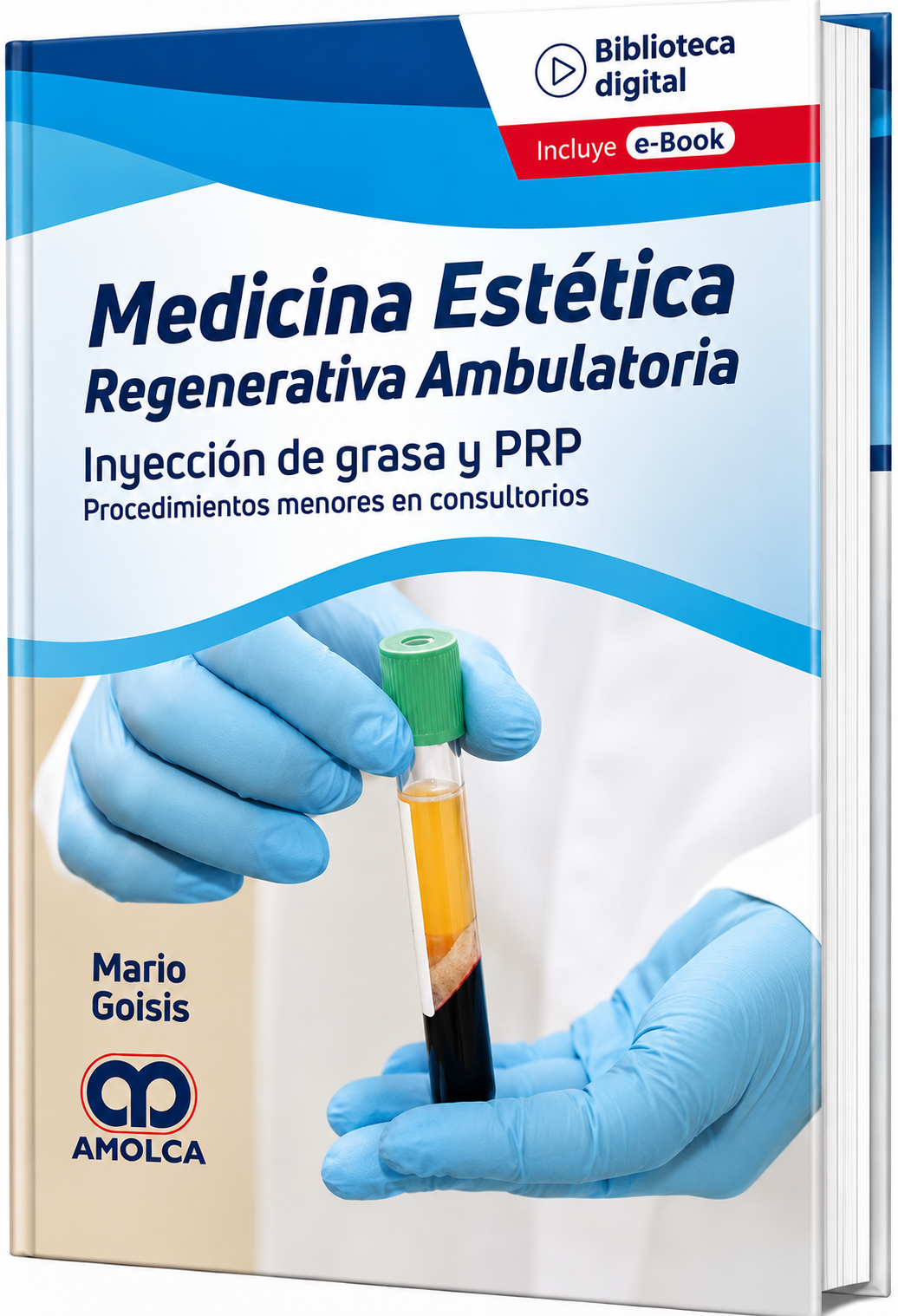 Medicina Estética Regenerativa Ambulatoria - Inyección de grasa y PRP