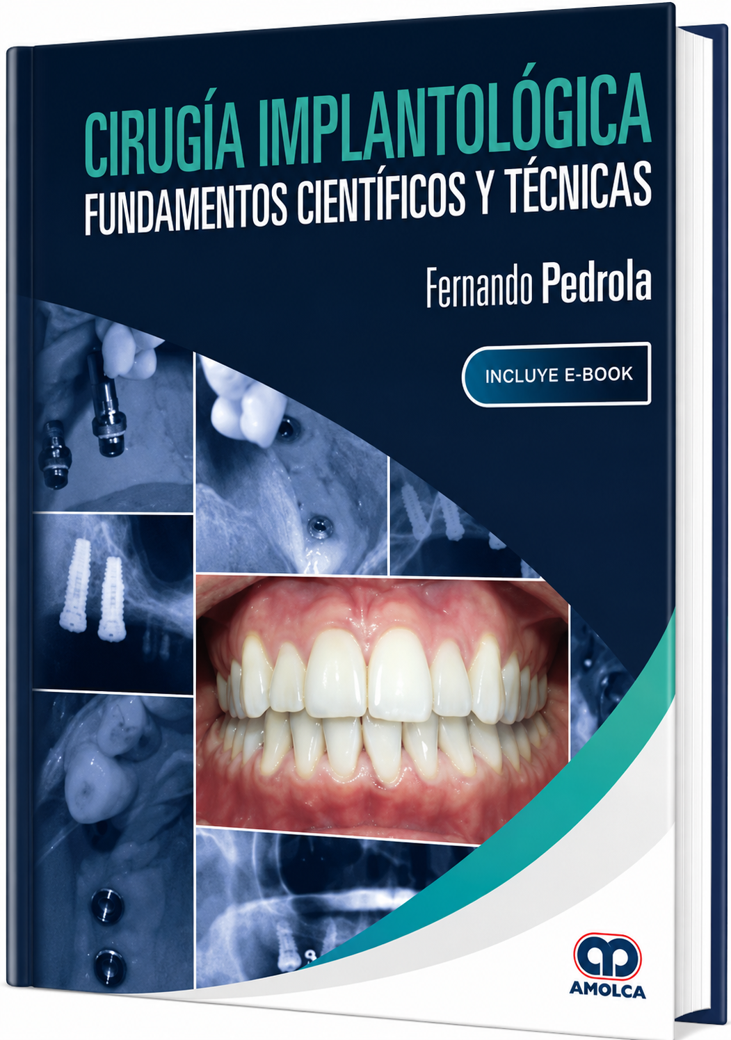 Cirugía Implantológica. Fundamentos Científicos y Técnicas