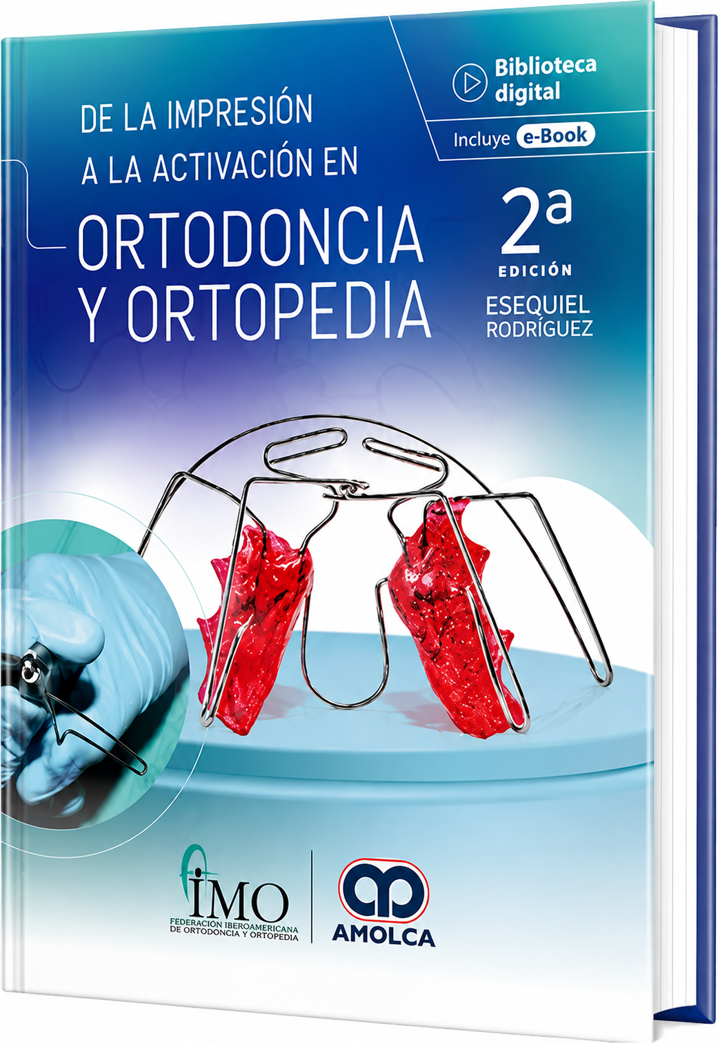 De la impresión a la activación en Ortodoncia y Ortopedia