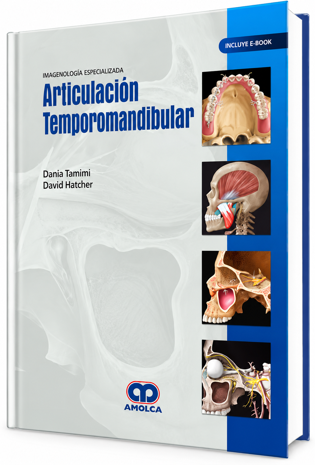 Imagenología Especializada. Articulación Temporomandibular